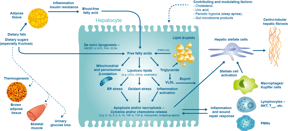 The substrate-overload liver injury model of NASH pathogenesis