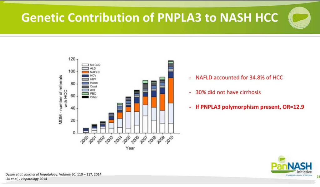 Genetic Contribution of PNPLA3 to NASH HCC