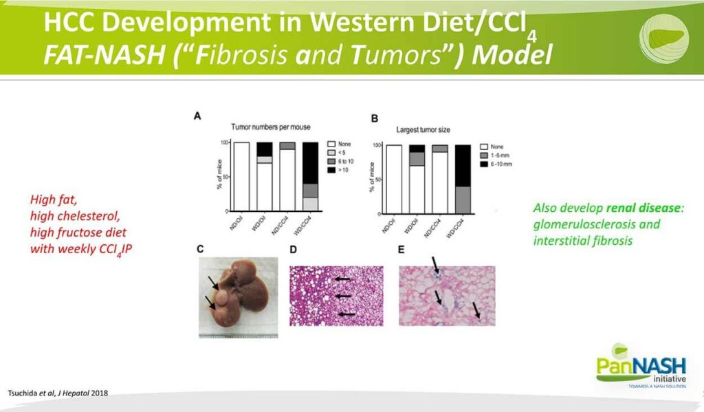 HCC Development in Western Diet/CCI4 FAT-NASH ("Fibrosis and Tumors") Model