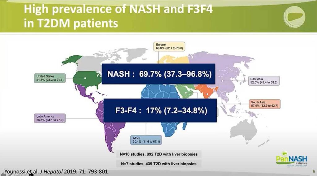 High Prevalence of NAFLD in T2DM patients & Limitations