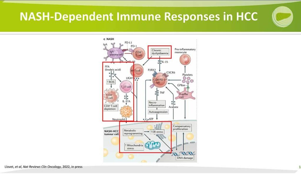 NASH-Dependent Immune Response in HCC