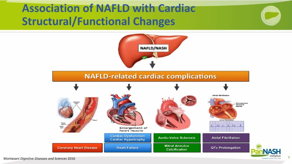 Association of NAFLD with Cardiac Structural Functional Changes