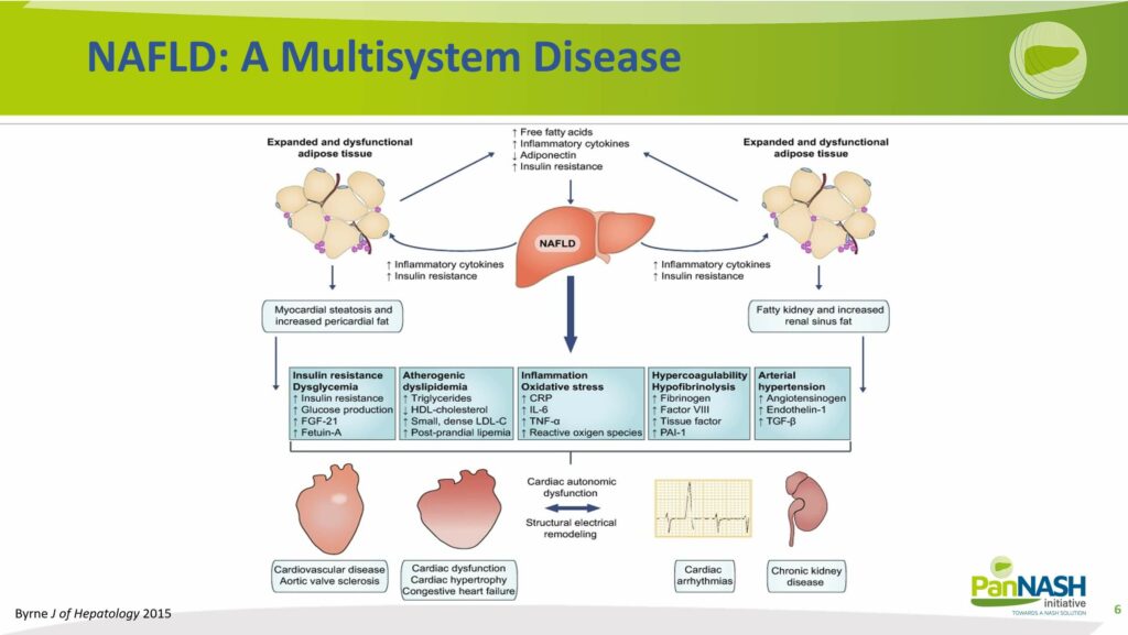 NAFLD A Multisystem Disease