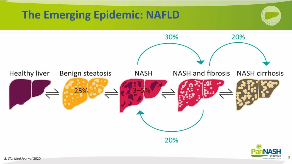 The Emerging Epidemic NAFLD