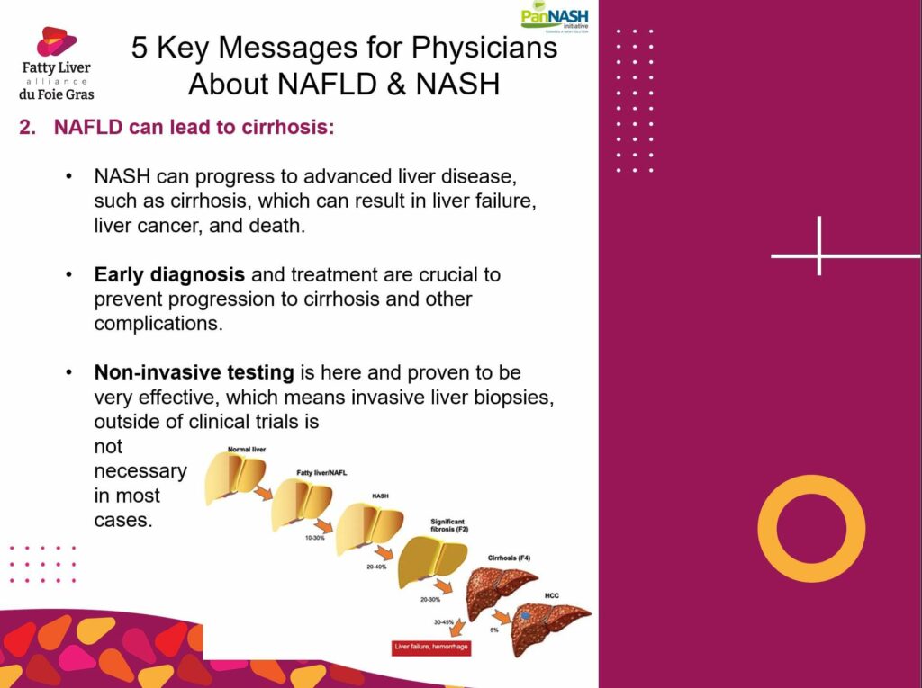 NAFLD can lead to cirrhosis