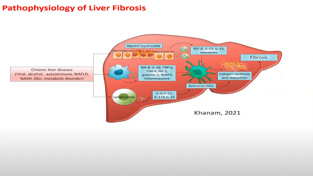 Exploring The Pathophysiology Of Liver Fibrosis Through Biomarkers